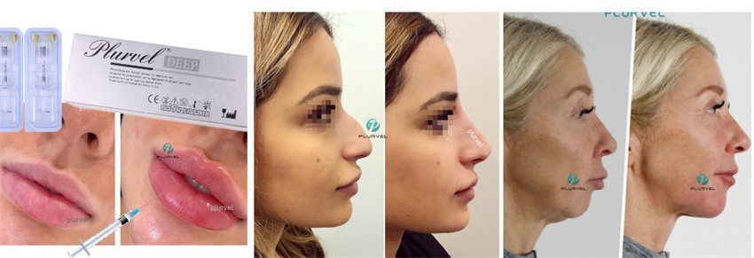 product-850-291 product-850-291