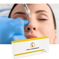Facial Fillers Dermal Filler Injection