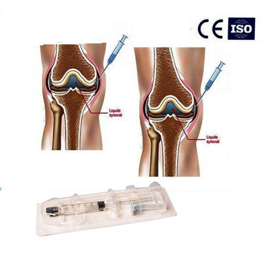 Hyaluronsyre Gel Knæledsindsprøjtning